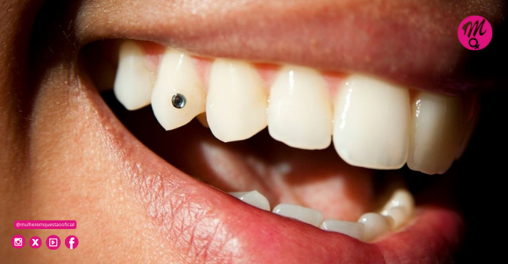 Cirurgião dentista explica se o uso de piercing no dente pode afetar a saúde bucal